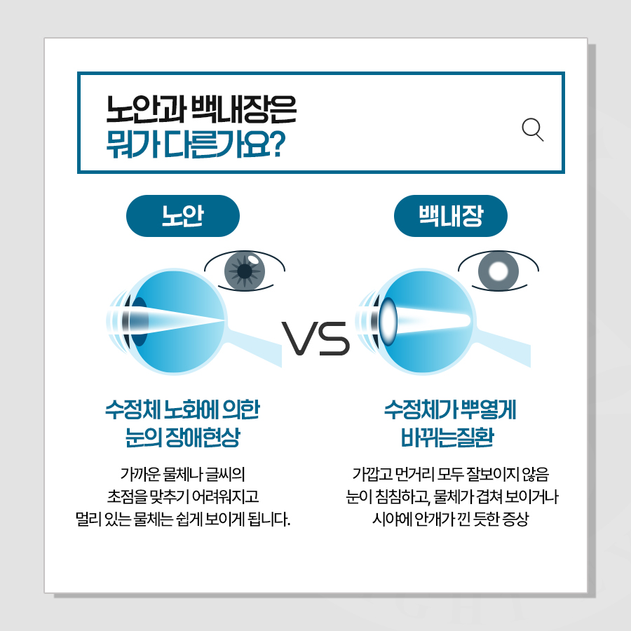 노안과 백내장은 뭐가 다른가요?